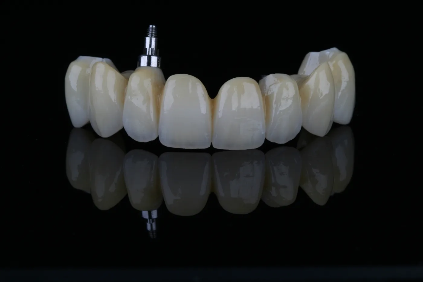 Verschraubte Zirkonbrücke auf Implantaten von ADU-Dental