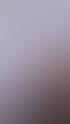 Eine Person erhält eine Injektion in die Lippen. Text: VOR einem Jahr bei mir war.